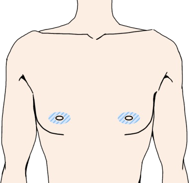 乳輪
